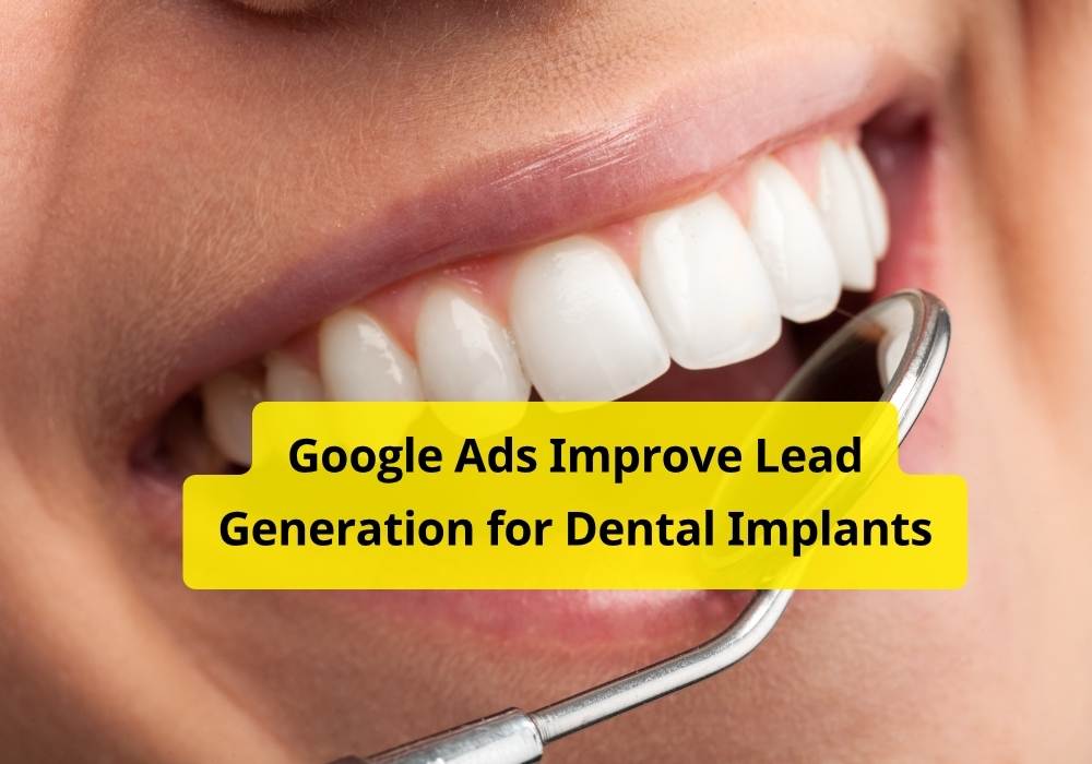 Google Ads Improve Lead Generation for Dental Implants